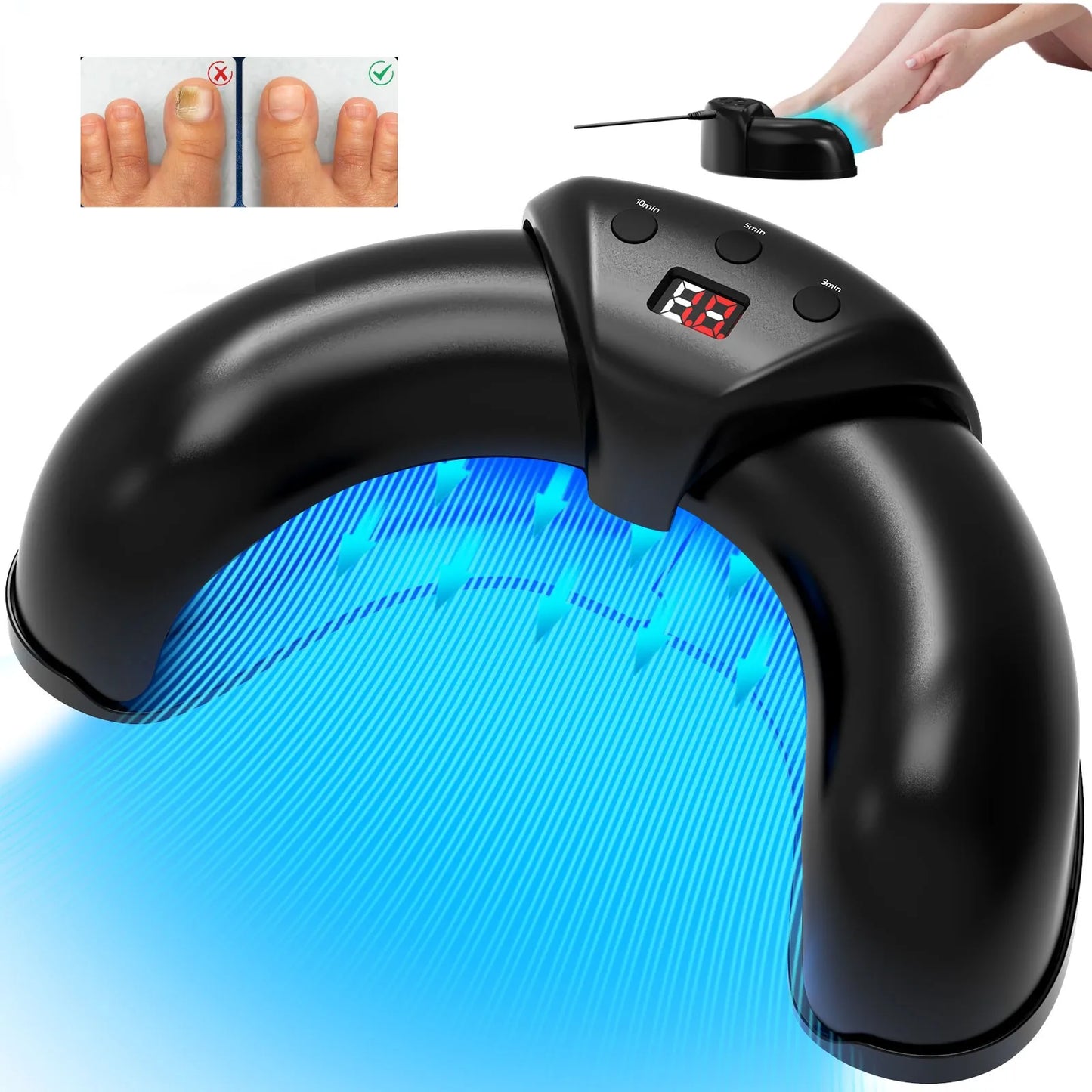 Nail Fungus Cleaning Laser Device with Time Display 470nm Blue Light and 910nm Red Light for Damaged Discolored Thick Fingernails and Foot Care