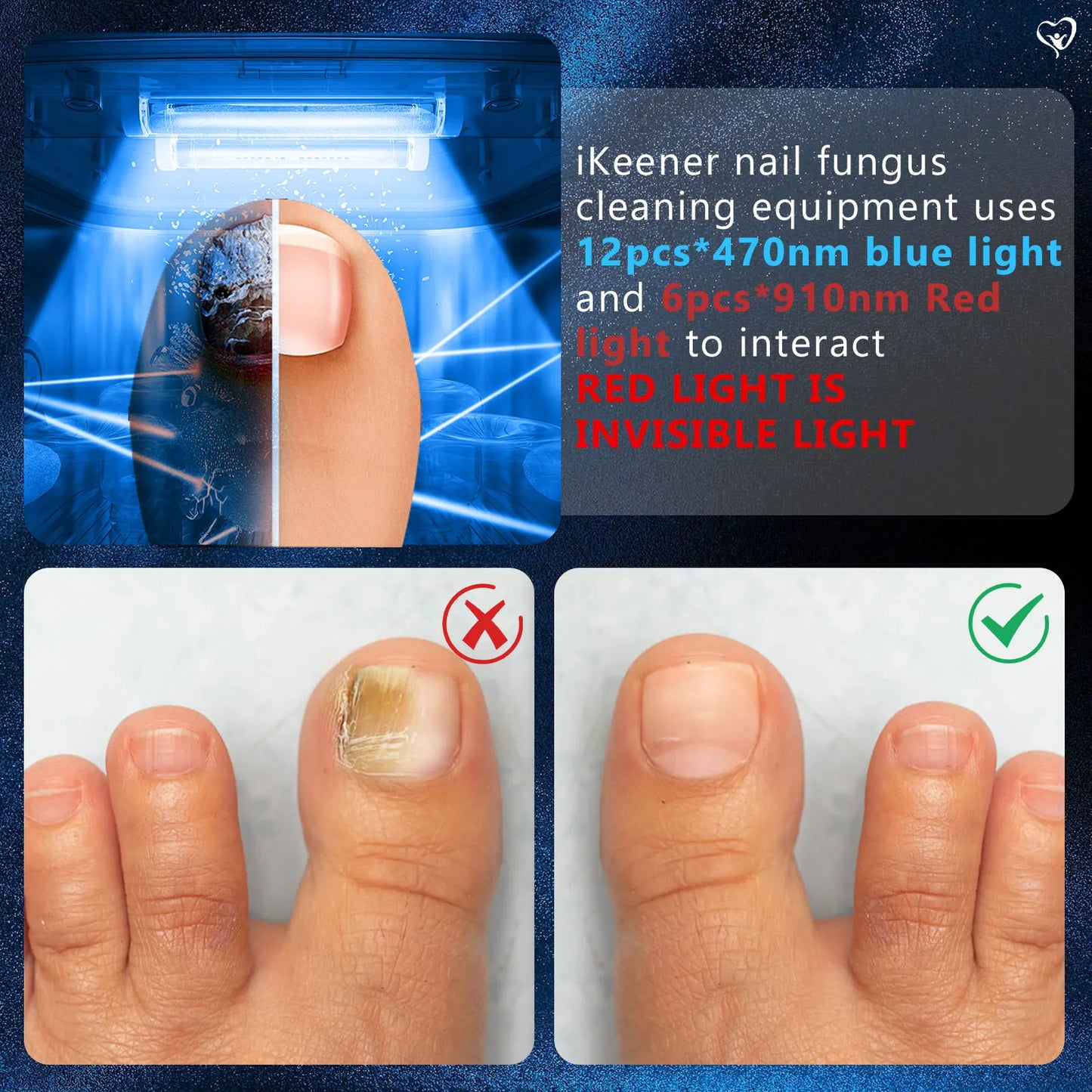 Nail Fungus Cleaning Laser Device with Time Display 470nm Blue Light and 910nm Red Light for Damaged Discolored Thick Fingernails and Foot Care