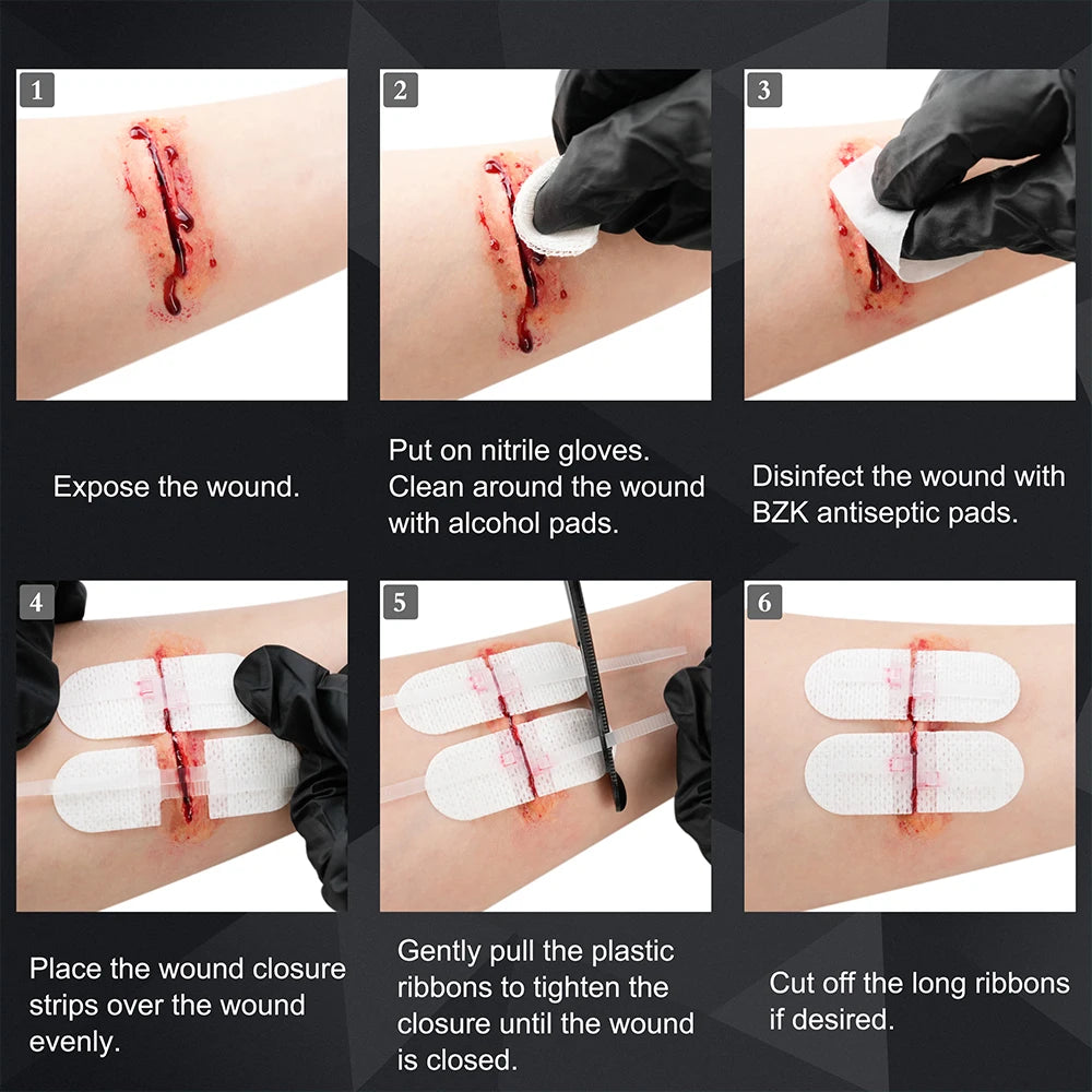 Rhino Rescue Zip Stitch Laceration Closure Kit with Wound Dressings and Closure Strips for Cut Care 6 Pieces