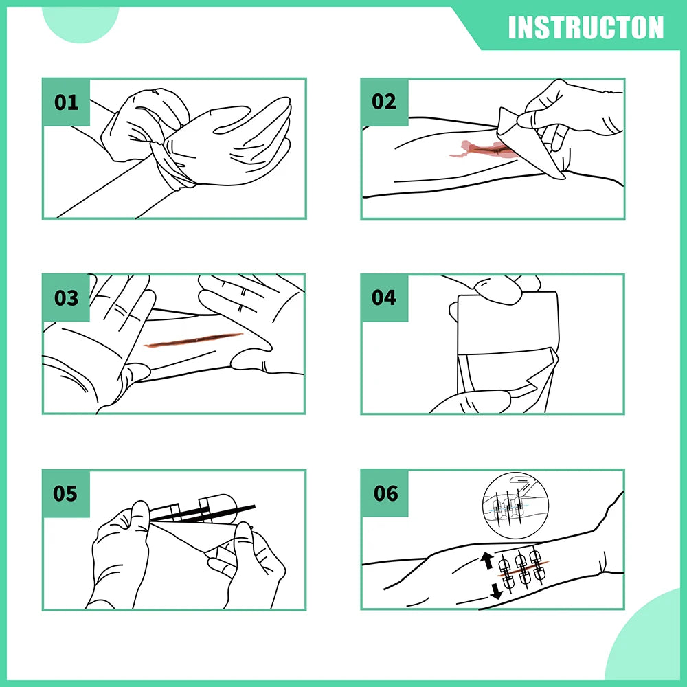 Rhino Rescue Zip Stitch Laceration Closure Kit with Wound Dressings and Closure Strips for Cut Care 6 Pieces