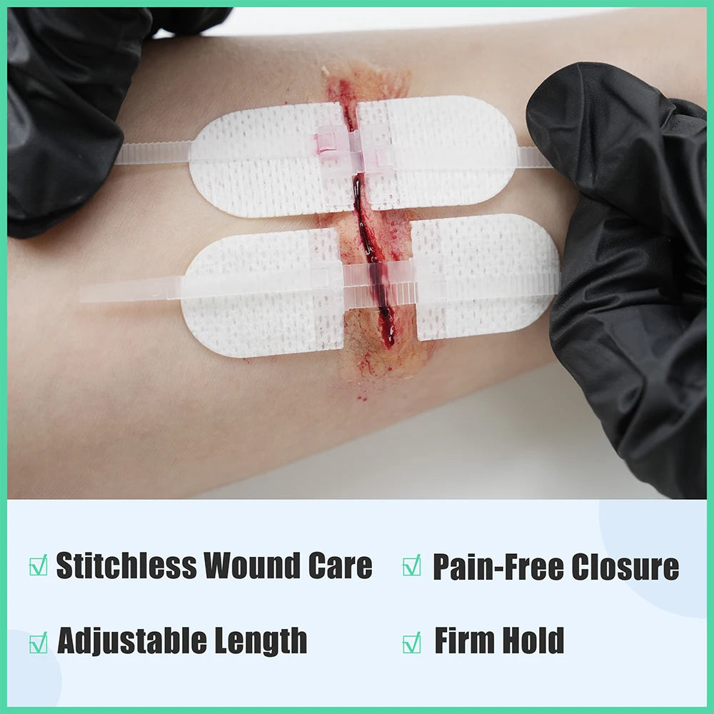 Rhino Rescue Zip Stitch Laceration Closure Kit with Wound Dressings and Closure Strips for Cut Care 6 Pieces